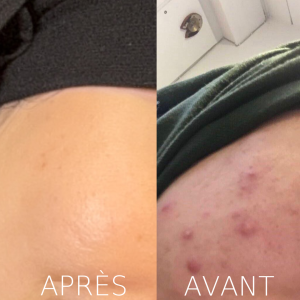 Box complet, peau parfaite 😍